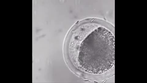 WATCH A DARPA NANBOT INSERT A RETARDED SPERM IN TO AN EGG!