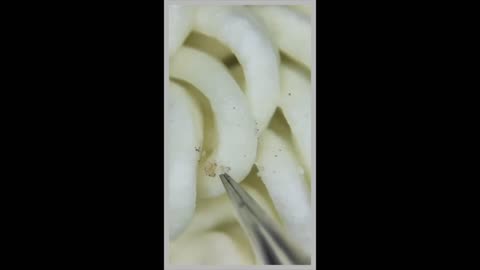 Noodles Under The Microscope. The Video That Exposes What You Do Not See (Must Watch!)