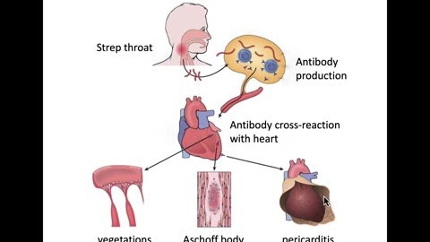 Cardiac Pathology Part 3