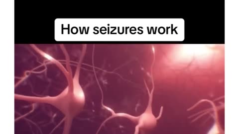 How seizures work