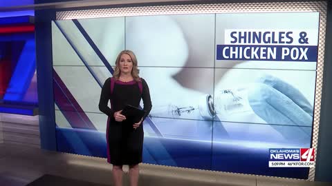 Chicken pox vaccine helps prevent risk of shingles