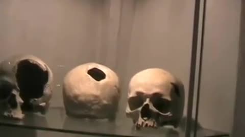 Czech Bone Storage