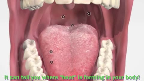 Virtual Tongue Analysis- Pictures Needed-See Description