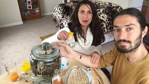 How to Remove Medical Leech from my Hand with Vinegar? Hirudotherapy with Tsetsi & Jelio