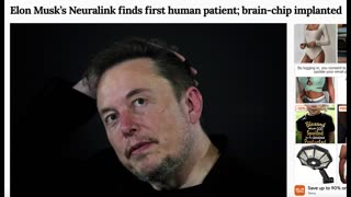 SHARE THIS! 1ST HUMAN UNDERGOES NEURALINK BRAIN CHIP TRANSPLANT! HOWEVER THIS ISN'T REALLY THE 1ST!