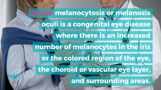 What Increases The Risk Of Eye Melanoma?