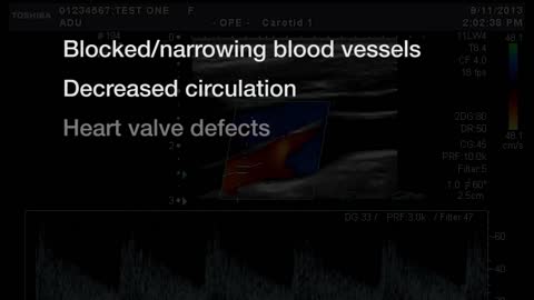 How Functional Ultrasound Works??