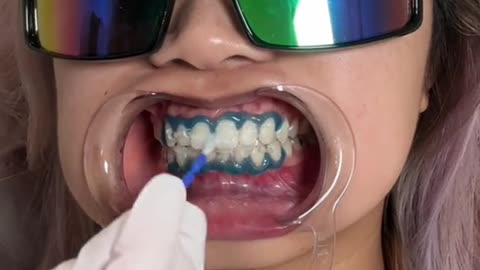 Have you been to your dentist recently Comment below 2