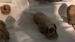 REAL ELONGATED SKULLS IN THE ICA MUSEUM IN PERU