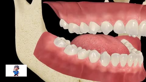 How Impacted Wisdom Teeth Are Removed ??