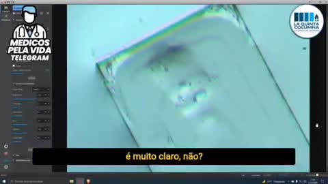 imagens de microscopia óptica do conteúdo da inoculação Pfisser