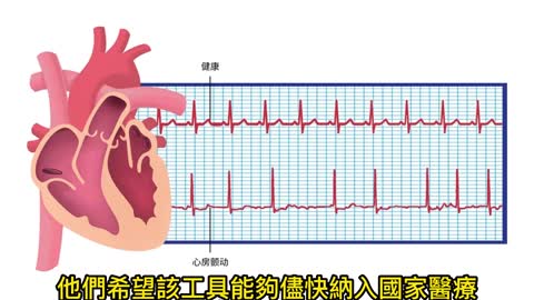 心房顫動患者 數量已增加72%