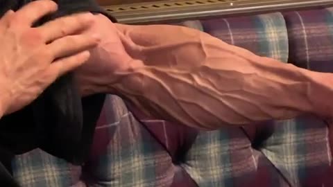 Check out this bodybuilder's arm the night before a competition