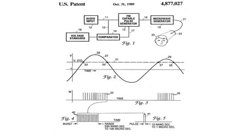 US Patent 4877027