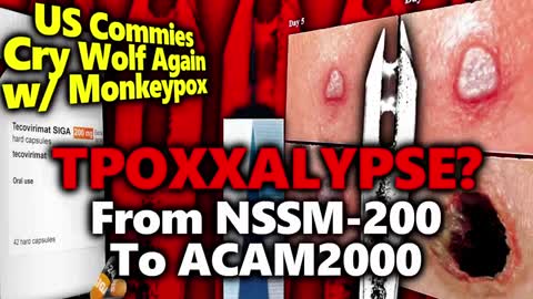 NO MENTION OF IMPAIRED SPERM OR DEADLY SHEDDING?! MEDIA PUSHES TPOXX & US' 100M DOSES OF ACAM2000