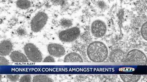 How to protect your children from monkeypox