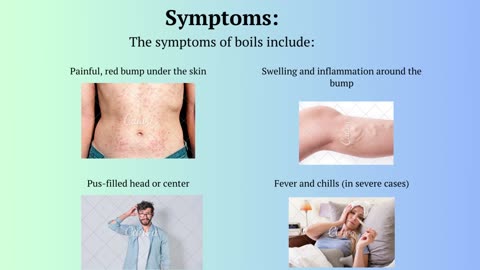 Acne and boils Causes, Symptoms, and Treatment