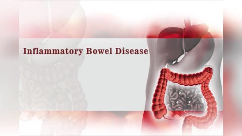 Inflammatory bowel disease