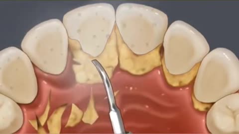 asmr teeth treatment animation | asmr teeth treatment | asmr teeth