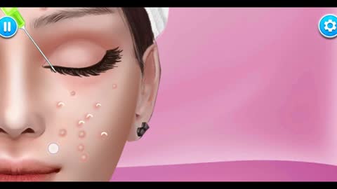 Acne treatment 👧🏻 through animation