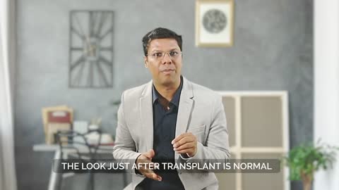 What Is Long Hair FUE Transplant- DR ASHOK SINHA