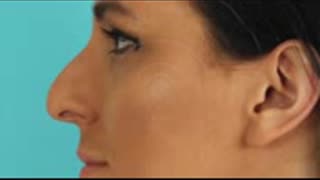 ⚡️GET A NATURAL RHINOPLASTY FAST- FIX YOUR NOSE NATURALLY- SUBLIMINAL AFFIRMATIONS FREQUENCY