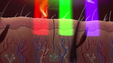 9 Low Level Lasers at Synergy Wellness! Most advanced, non-invasive Low Level Lasers in the World!