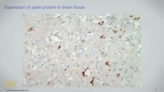 Expression of Spike Protein in Heart, Lung and Brain Tissue - Dr. Ryan Cole