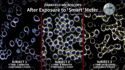 EMF effects on blood