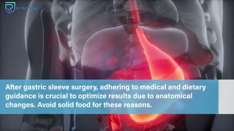 Reasons to Avoid Solid Food After Gastric Sleeve