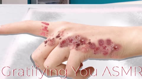 ASMR treatment || Full skin problem