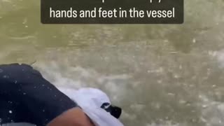 Bull Shark bites off mans hand in The Everglades