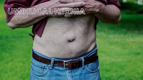 Large Intestine and Umbilical Hernias