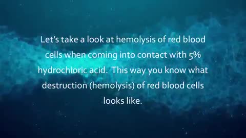 CHLORINE DIOXIDE AKA MMS/CDS AND THE BENEFITS WHEN USED TO TREAT DISORDERS OF BLOOD VISCOSITY