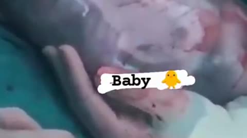 Doctor_status || Baby _Born_video||