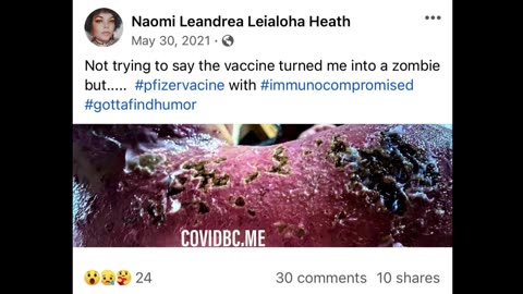 Horrific Photos on Social Media - Vaccine-induced Skin Disease - Here's Video Proof