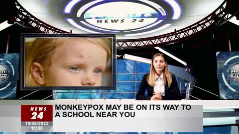 Monkeypox can be on the way to a school near you