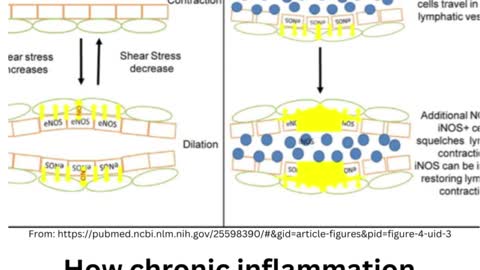 Chronic Inflammation and its impact on lymph flow