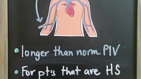 Types of IV