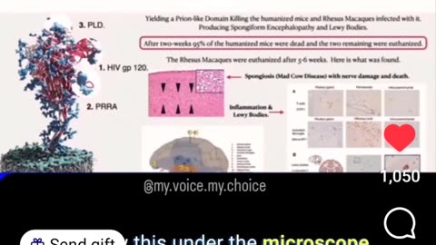 HIV In The Spike Protein Of The Vaccine