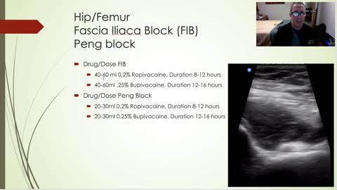 Peripheral Nerve Blocks in the ED