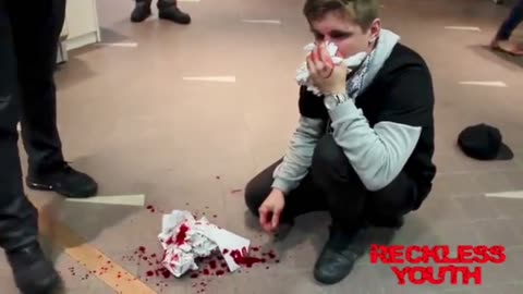 Aussie Youtube Star gets broken nose