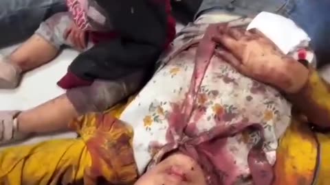 Injured children at Gaza hospital as Isreali bombing continues