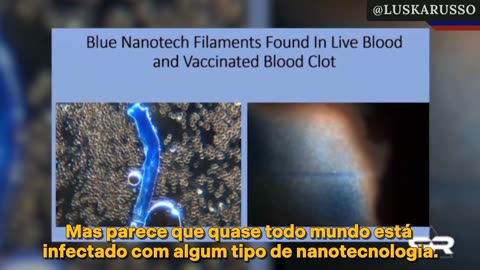 Nanotecnologia baseada em Pontos Quânticos dentro do 🩸 de 💉 e não 💉