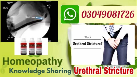 Urethral stricture !! homeopathic medicine for urethral stricture | explain in hindi