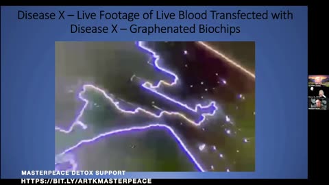 💥 GRAPHENATED BIOCHIPS & MICROSENSORS Found in Human Blood! Get UN-HACKED ASAP with MASTERPEACE!💥