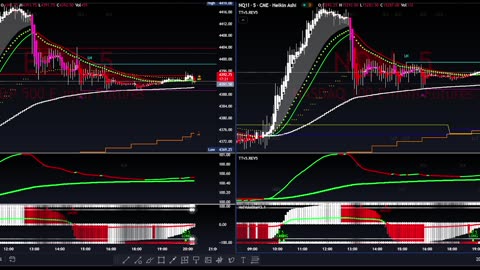 Trigger Trades v5.3 Elite