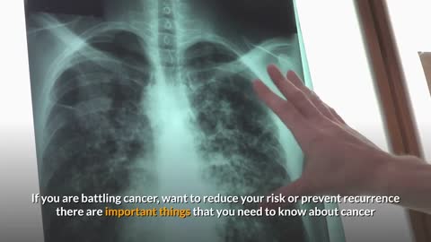 What your doctor may not tell you about cancer