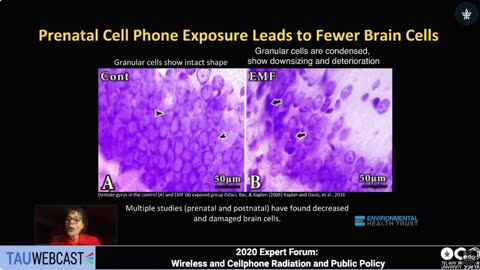 Prenatal cell phone exposure leads to fewer brain cells. #EMF