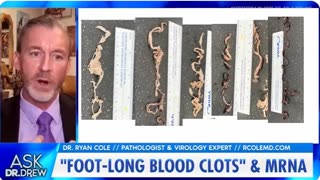 Blood Clots and Covid Shots: Conspiracy Theory vs Scientific Evidence